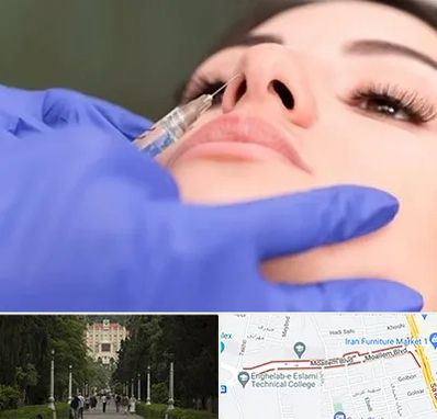 هیالاز در بلوار معلم رشت 