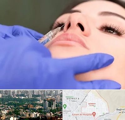 هیالاز در عظیمیه کرج 