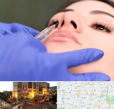 هیالاز در جنت آباد تهران 