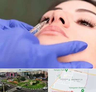 هیالاز در تهرانسر 