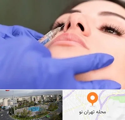 هیالاز در تهران نو