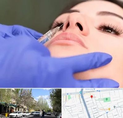 هیالاز در کوی فیروز تبریز