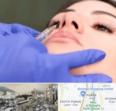 هیالاز در پونک 