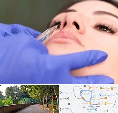 هیالاز در بلوار گیلان رشت