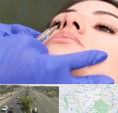 هیالاز در منطقه 17 تهران 