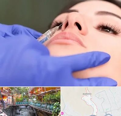 هیالاز در درکه