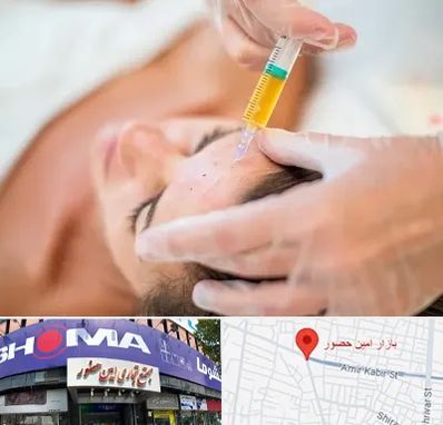 پی آر پی در امین حضور