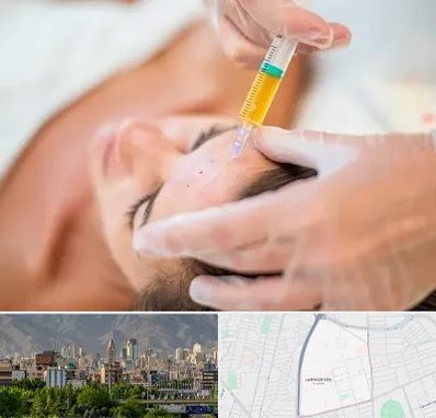 پی آر پی در جمشیدیه