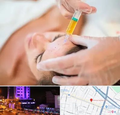 پی آر پی در آبرسان تبریز