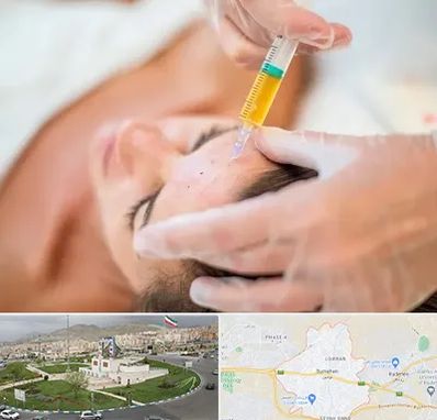 پی آر پی در بومهن