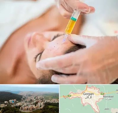 پی آر پی در گرگان