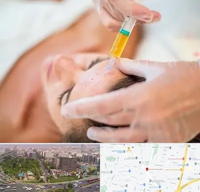 پی آر پی در آیت الله کاشانی 