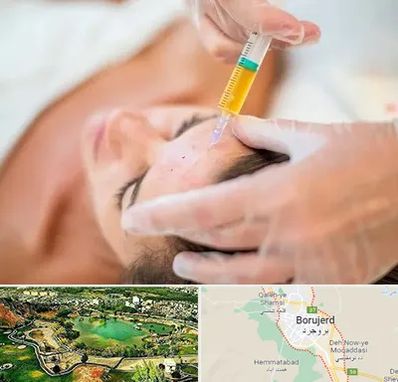 پی آر پی در بروجرد