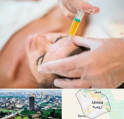 پی آر پی در ارومیه