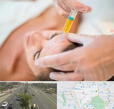 پی آر پی در منطقه 17 تهران 