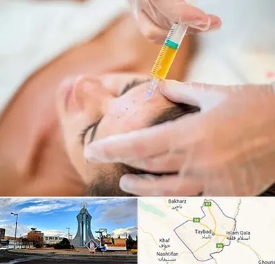 پی آر پی در تایباد