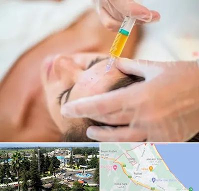 پی آر پی در رودسر