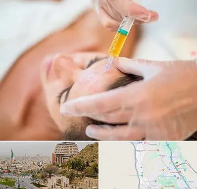 پی آر پی در فرهنگ شهر شیراز