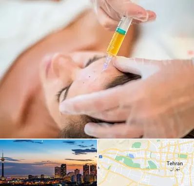 پی آر پی در غرب تهران 