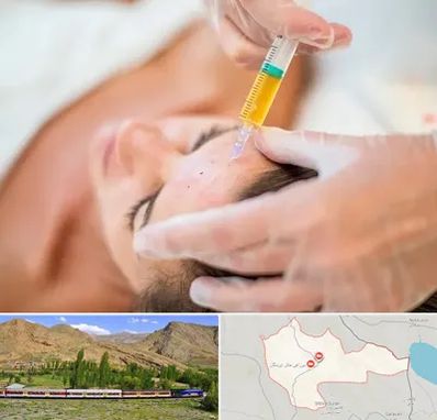 پی آر پی در خاش