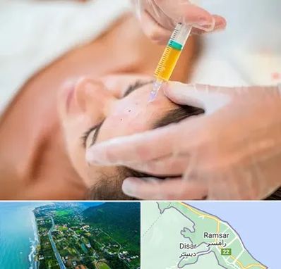 پی آر پی در رامسر