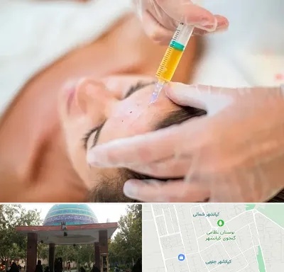 پی آر پی در کیانشهر
