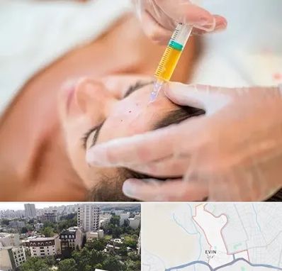 پی آر پی در اوین