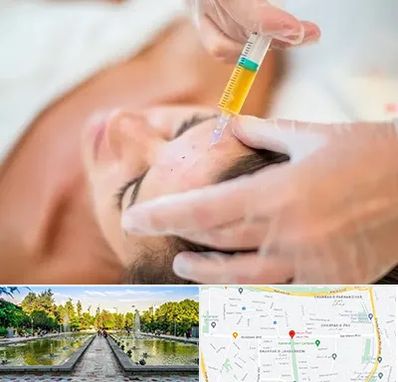 پی آر پی در سرسبز 