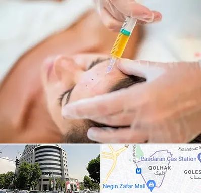 پی آر پی در قلهک 