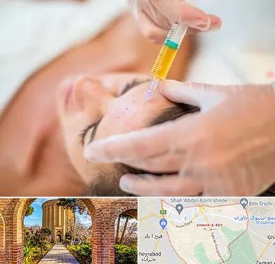 پی آر پی در شهر ری