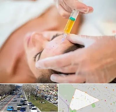 پی آر پی در احمدآباد مشهد 