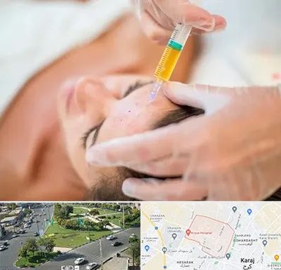 پی آر پی در شاهین ویلا کرج