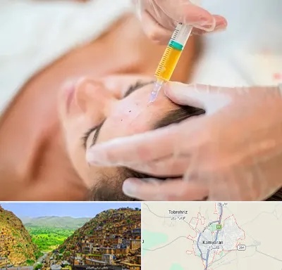 پی آر پی در کامیاران