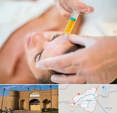 پی آر پی در ایرانشهر