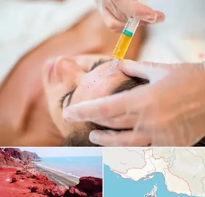 پی آر پی در هرمزگان
