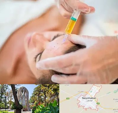 پی آر پی در نیشابور