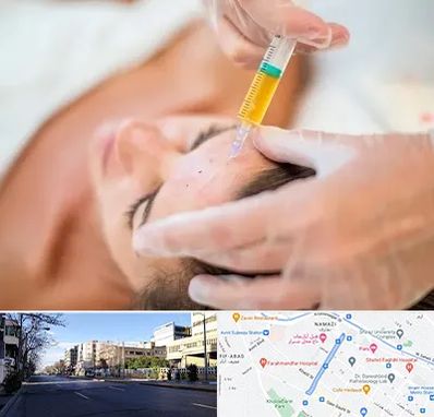 پی آر پی در خیابان ملاصدرا شیراز