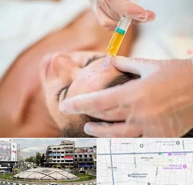 پی آر پی در مرکز تهران