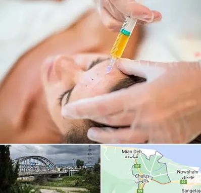 پی آر پی در چالوس