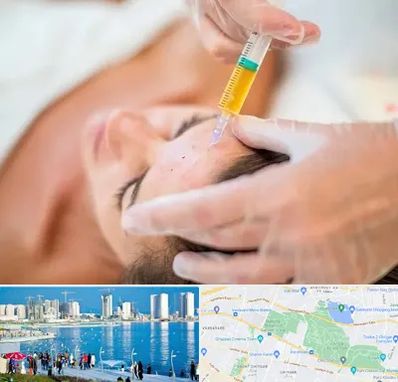 پی آر پی در چیتگر 