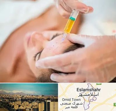 پی آر پی در اسلامشهر