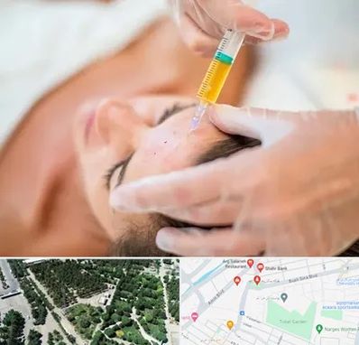 پی آر پی در سالاریه قم