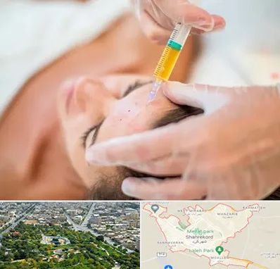 پی آر پی در شهرکرد