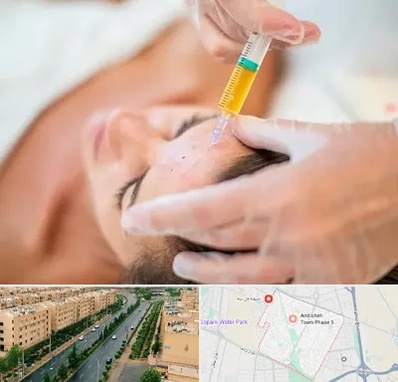 پی آر پی در فاز سه اندیشه