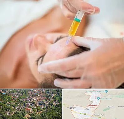 پی آر پی در دماوند