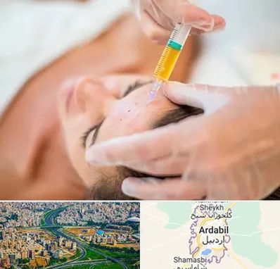 پی آر پی در اردبیل