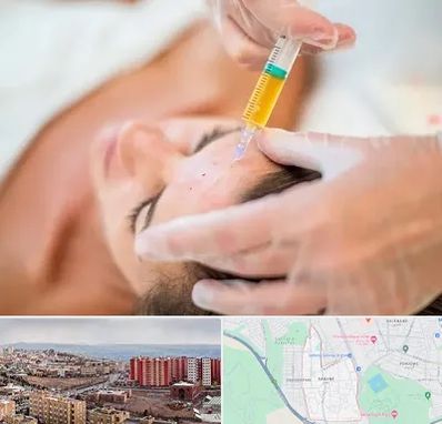 پی آر پی در سهند تبریز