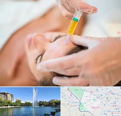 پی آر پی در کوهسنگی مشهد