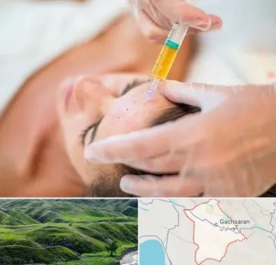 پی آر پی در گچساران