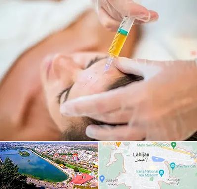 پی آر پی در لاهیجان